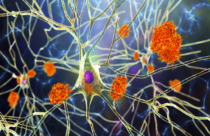 البيض في مواجهة ألزهايمر.. دراسة تكشف ارتباطا محتملا