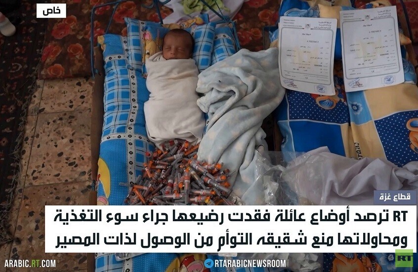 سوء التغذية يضرب أطفال قطاع غزة