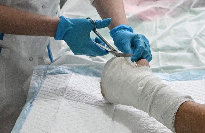 روسيا.. ابتكار غرسات مع مضاد حيوي تنقذ الجرحى من العدوى