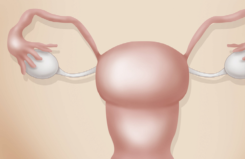 خطوة واعدة في محاربة أسباب نقص الخصوبة لدى النساء