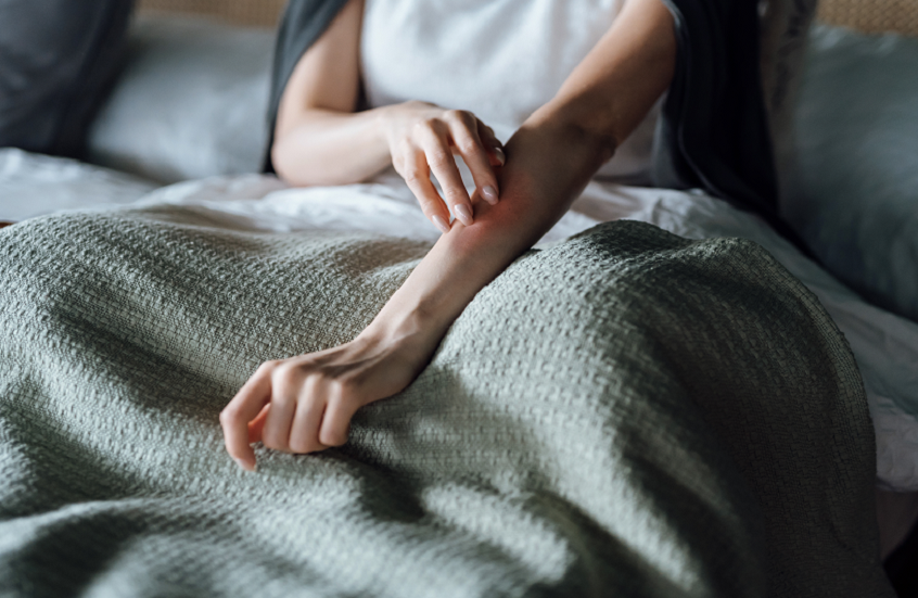 دراسة تكشف عن ارتباط الإكزيما بأمراض الكلى المزمنة