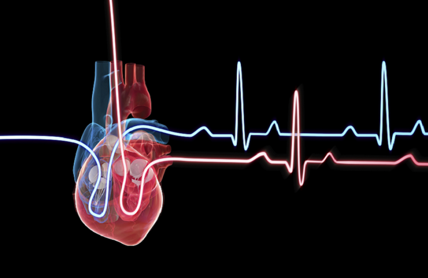 كيفية التصرف عند الاشتباه بالنوبة القلبية في الطقس الحار