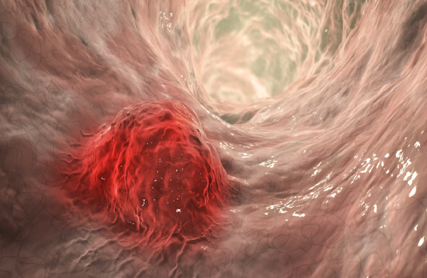 مصادر غير متوقعة للألياف تعزز صحتك اليومية