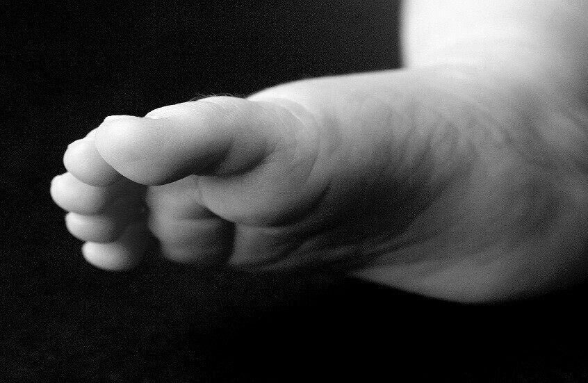 أسباب متعددة للوذمة