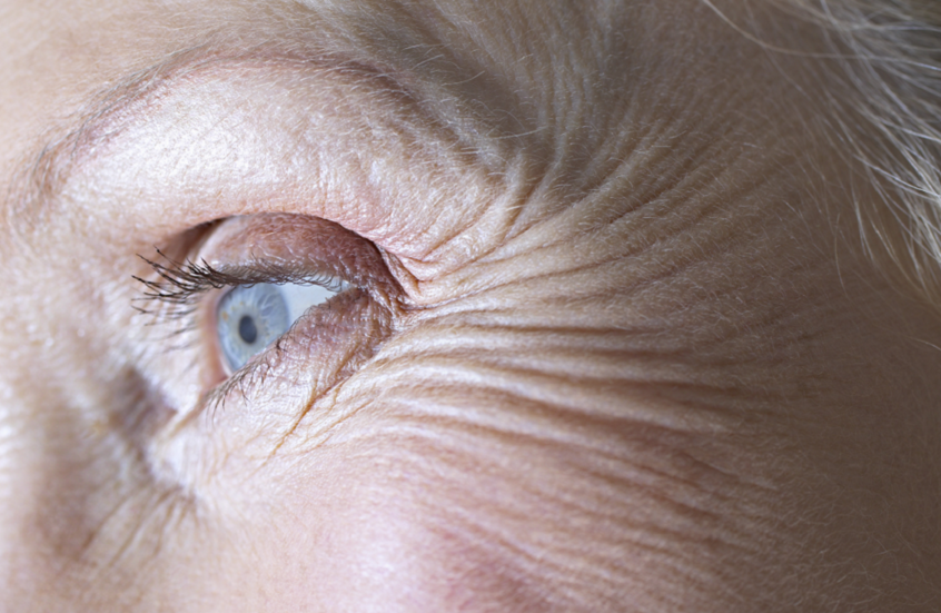 تفسير علمي لظهور التجاعيد مع التقدم في العمر