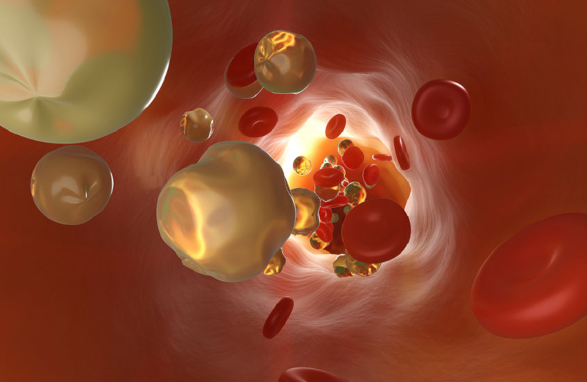 فواكه فعّالة في خفض الكوليسترول وتحسين صحة القلب