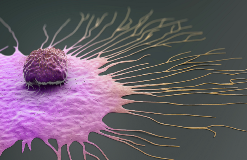 اختراق هام في علاج سرطان الثدي.. اكتشاف مفتاح رئيسي لمنع تطور وانتشار المرض
