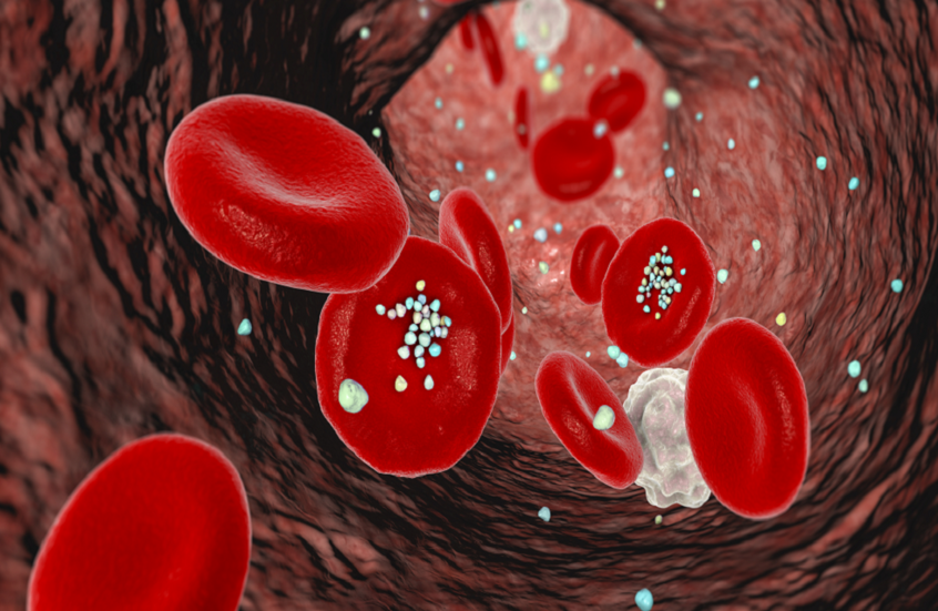 دراسة تكشف عن مستويات صادمة للبلاستيك الدقيق في هواء منازلنا وسياراتنا