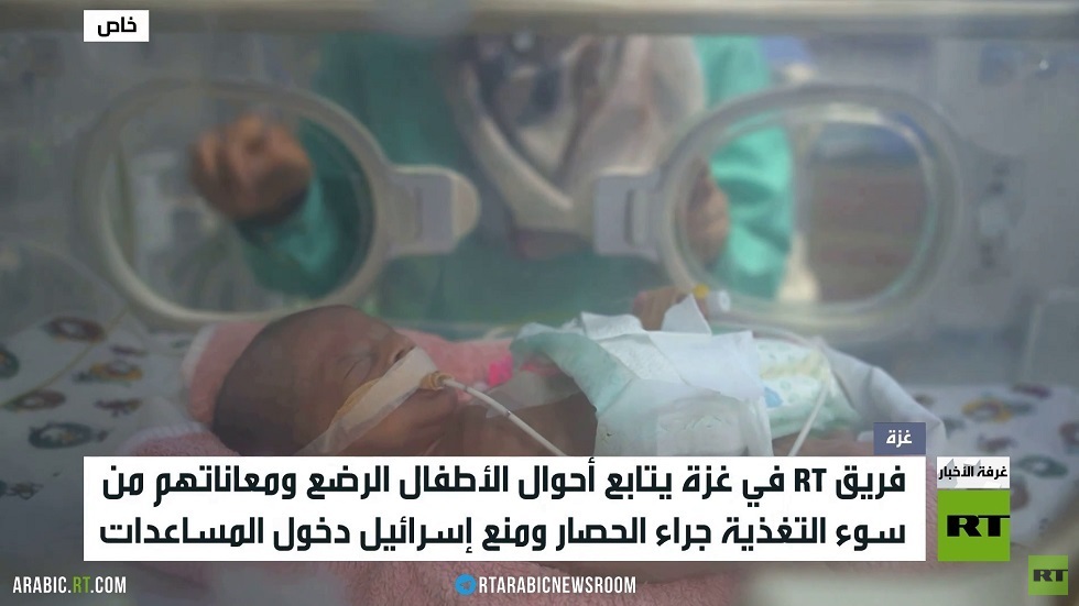 أطفال غزة.. سوء التغذية والموت جوعا