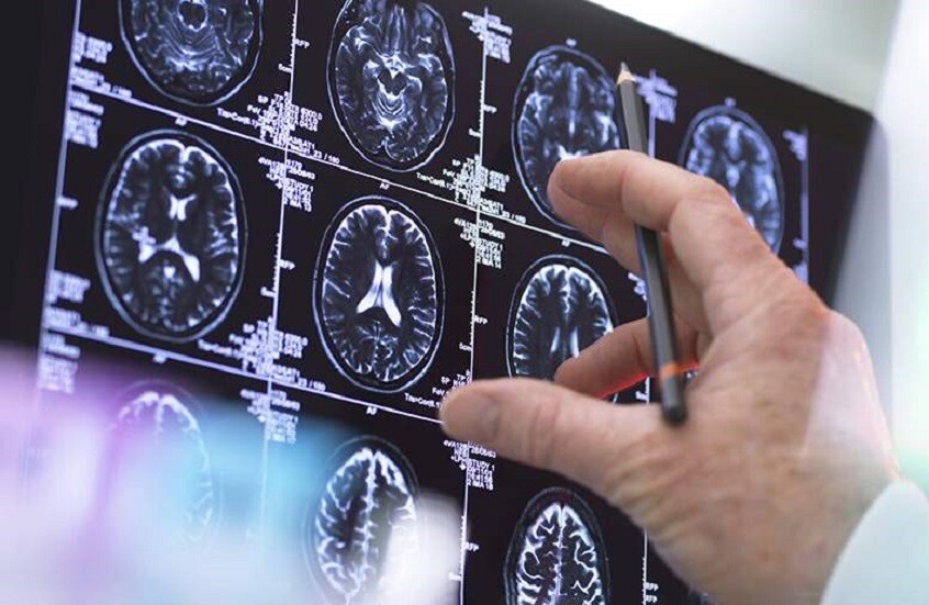 روائح غير عادية قد تشير إلى وجود ورم في الدماغ