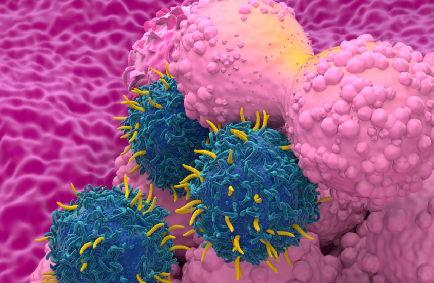 علاج أول مريضة أمريكية بعقار إشعاعي مبتكر لسرطان الثدي المتقدم