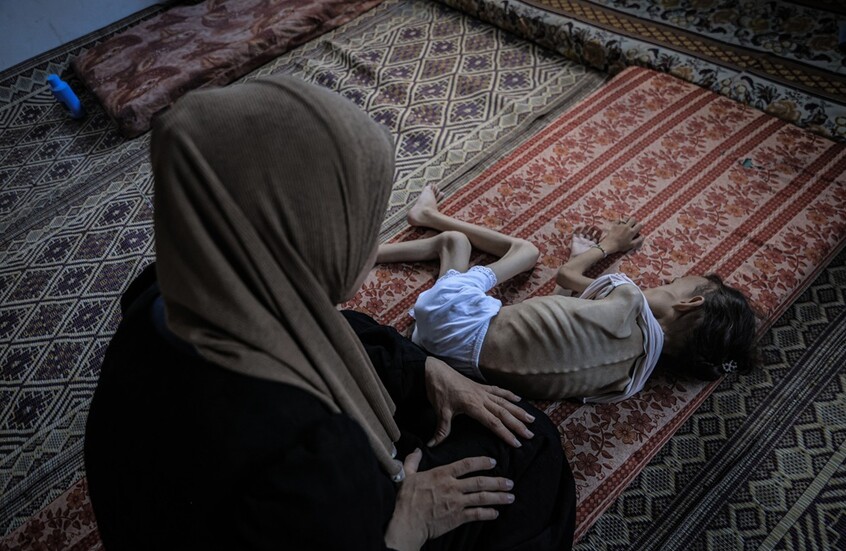 صحة غزة: ارتفاع حصيلة ضحايا الجوع إلى 180 بينهم 93 طفلا