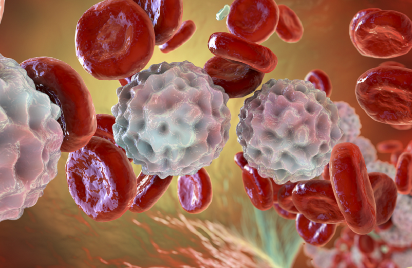 اكتشاف علاج واعد لأحد أخطر أنواع سرطان الدم