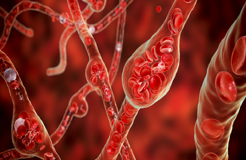 مكمل طبيعي يثبت فعاليته في خفض ضغط الدم المرتفع