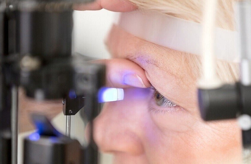 التهاب الملتحمة.. أعراض تستدعي زيارة الطبيب