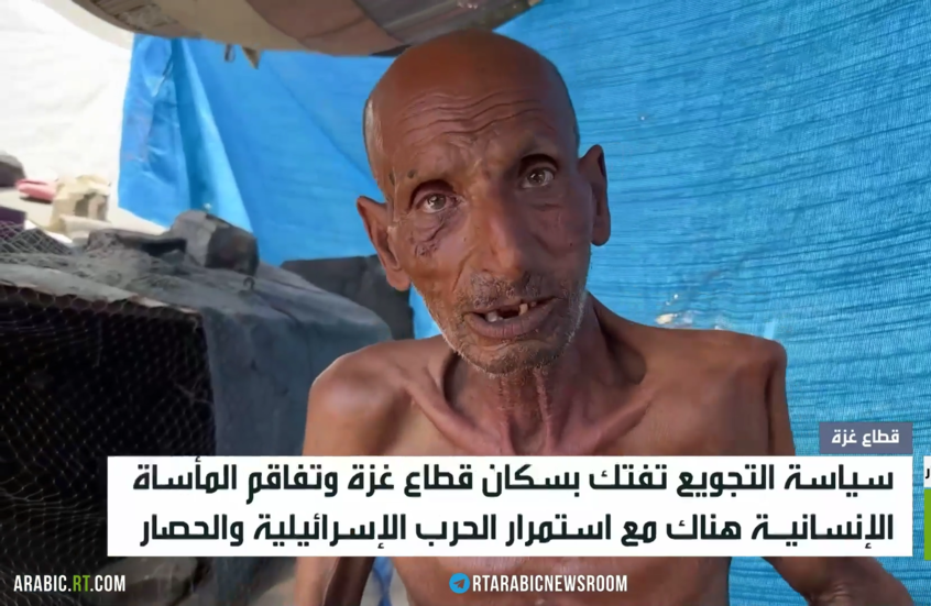 مأساة التجويع تفتك بسكان غزة