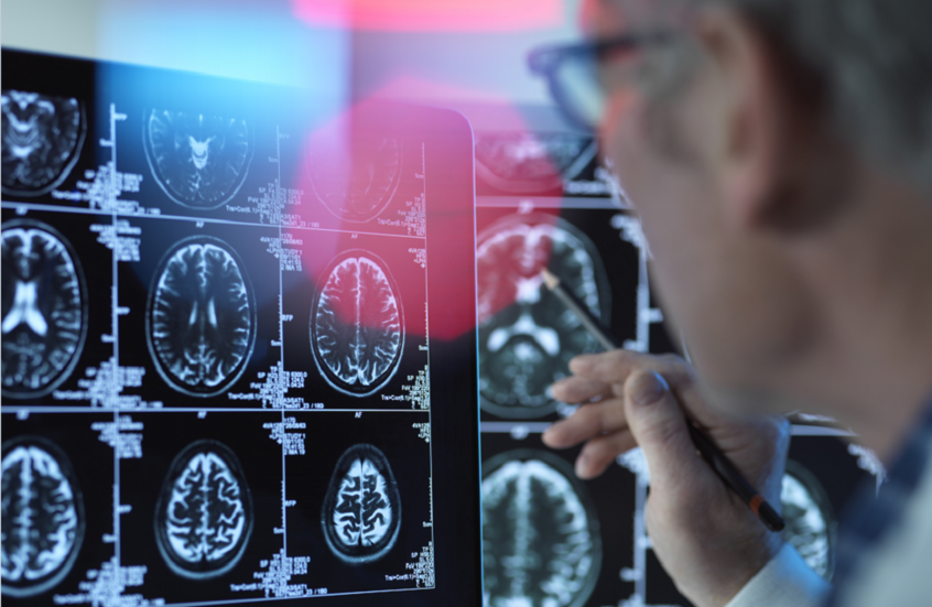 دراسة: أجهزة السمع يمكنها الحد من خطر الخرف بنسبة كبيرة