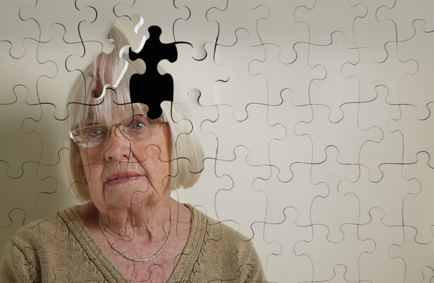 مكمل غذائي شائع قد يحمي النساء من الخرف