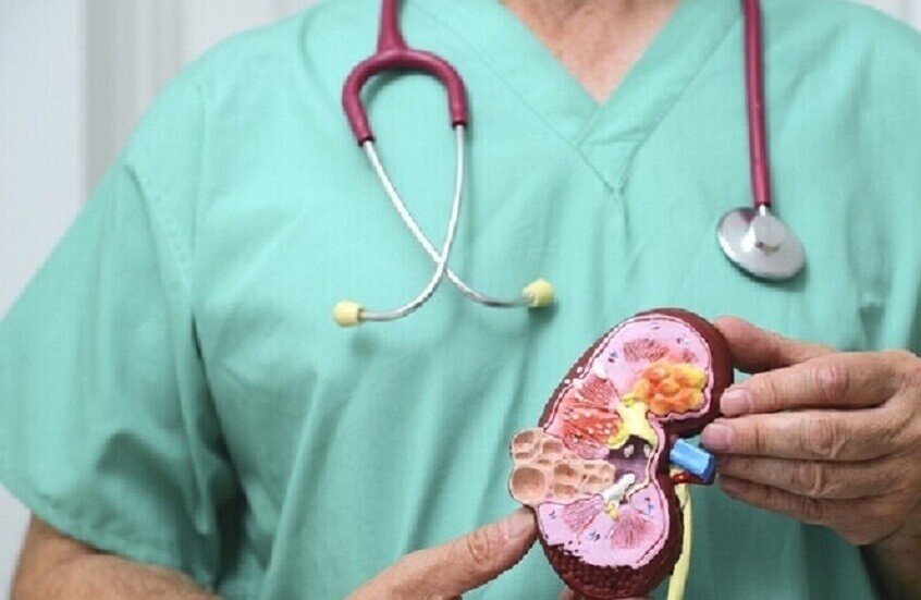 عوامل الخطر الرئيسية لتكون حصى المسالك البولية