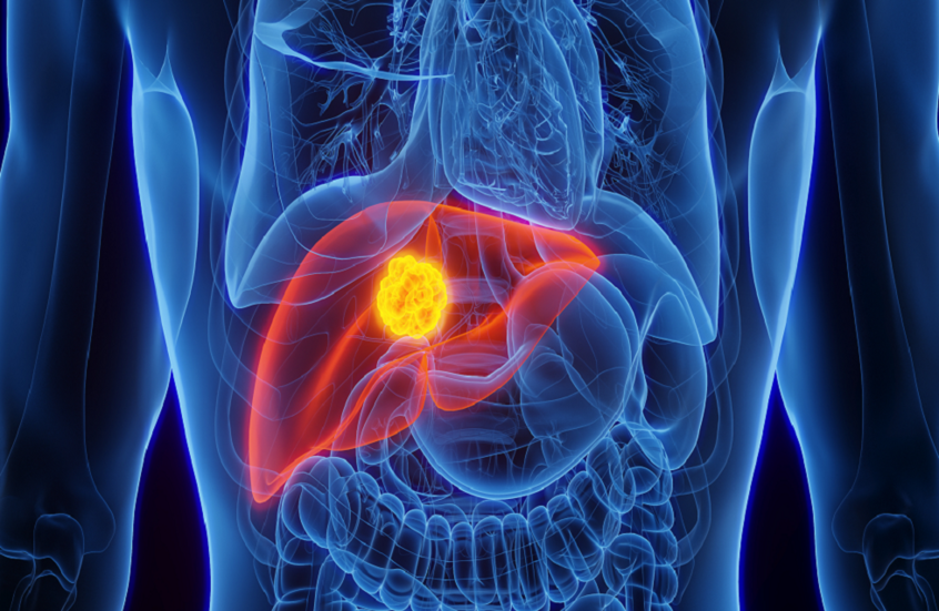 طريقة فعالة لتقليل تأثير الكحول على الكبد