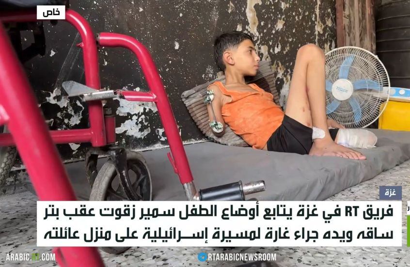 أطفال غزة.. مواجهة الجوع وبتر الأطراف