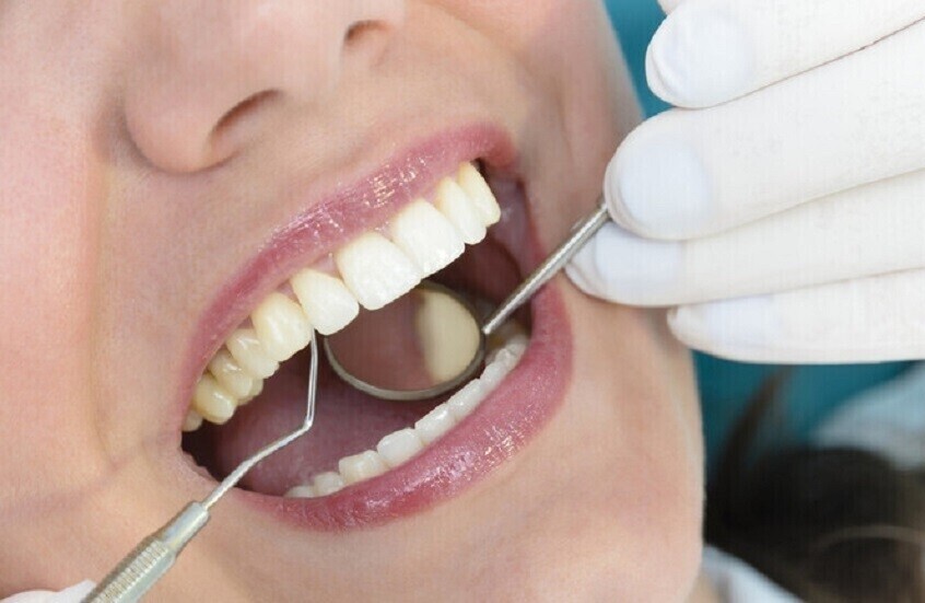 أعراض بسيطة لكنها خطيرة.. متى يجب مراجعة أخصائي تقويم الأسنان؟