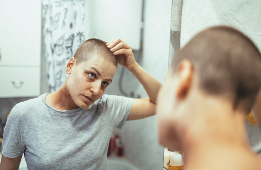 ابتكار جديد يحمي الشعر من التساقط أثناء العلاج الكيميائي