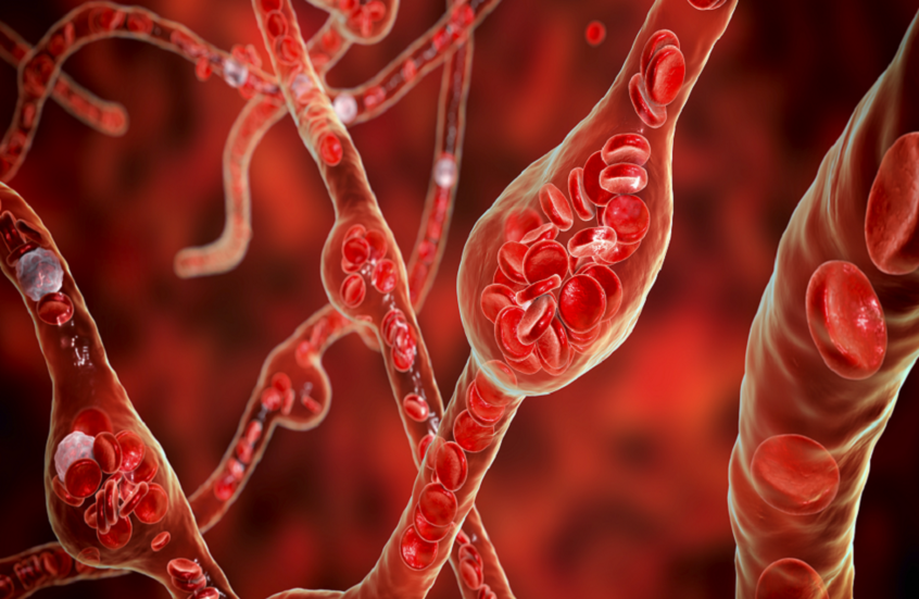 مكوّن شائع في طعامك اليومي قد يضر قلبك ويرفع ضغط الدم