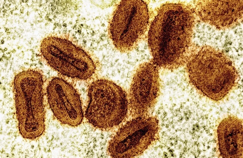 الصحة العالمية: جدري القردة لم يعد حالة طوارئ صحية دولية