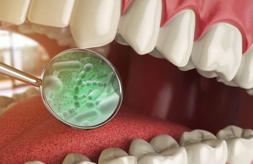 دراسة جديدة تكشف دور البكتيريا الفموية في النوبات القلبية