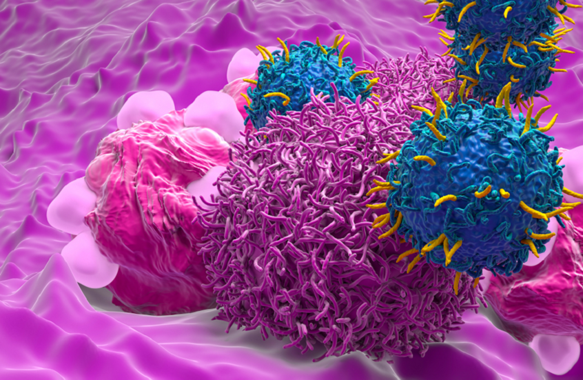 "خطر خفي" يواجه الناجيات من سرطان عنق الرحم