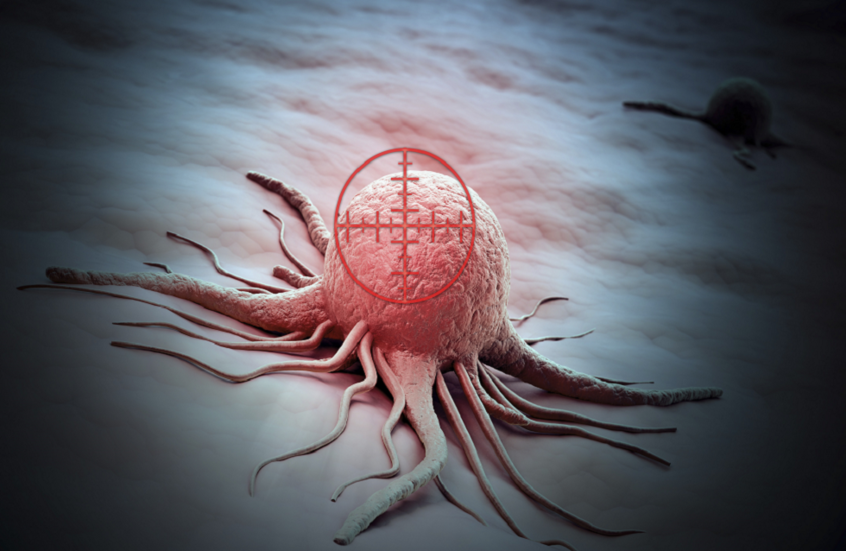 بجلسة واحدة فقط.. تمارين رياضية تكبح نمو الخلايا السرطانية