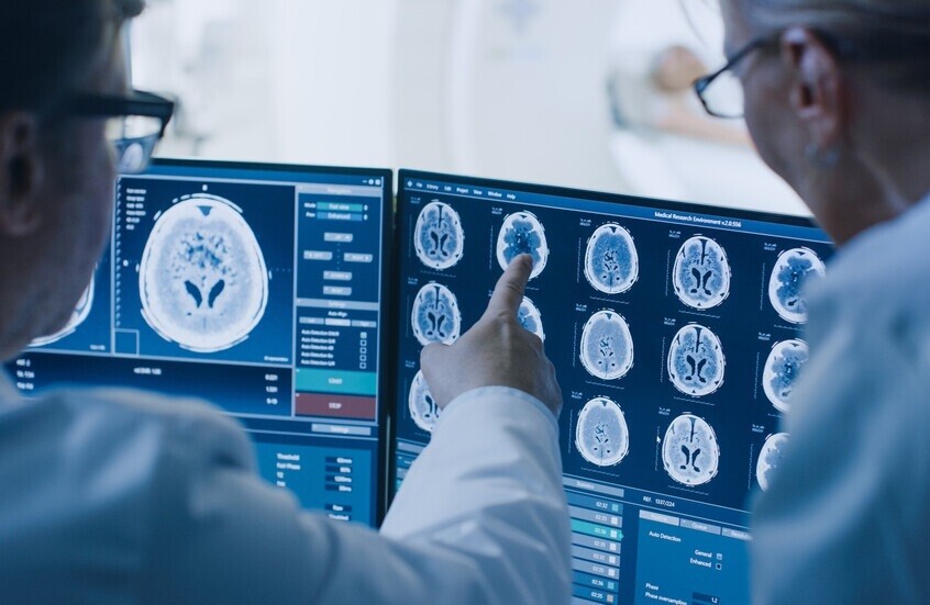 عامل يسرع تطور سرطان الدماغ