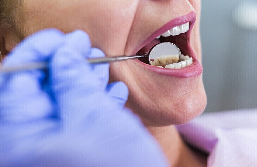 ابتكار روسي يغير قواعد حماية الأسنان من التسوس وأمراض اللثة