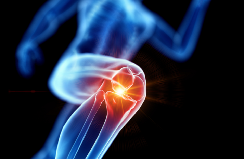 الألياف البلاستيكية الدقيقة وتأثيرها على قوة العظام