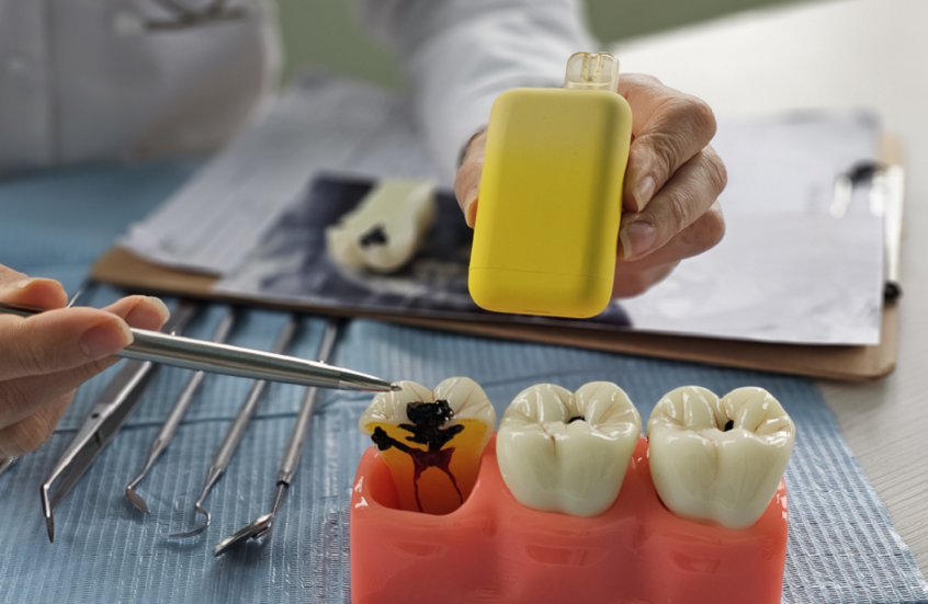 تأثير السجائر الإلكترونية المدمر على الأسنان وصحة الفم