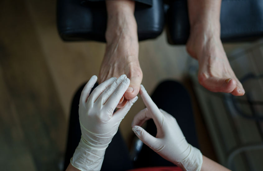 علامات بسيطة في القدمين قد تكشف عن مرض خطير يهدد الحياة