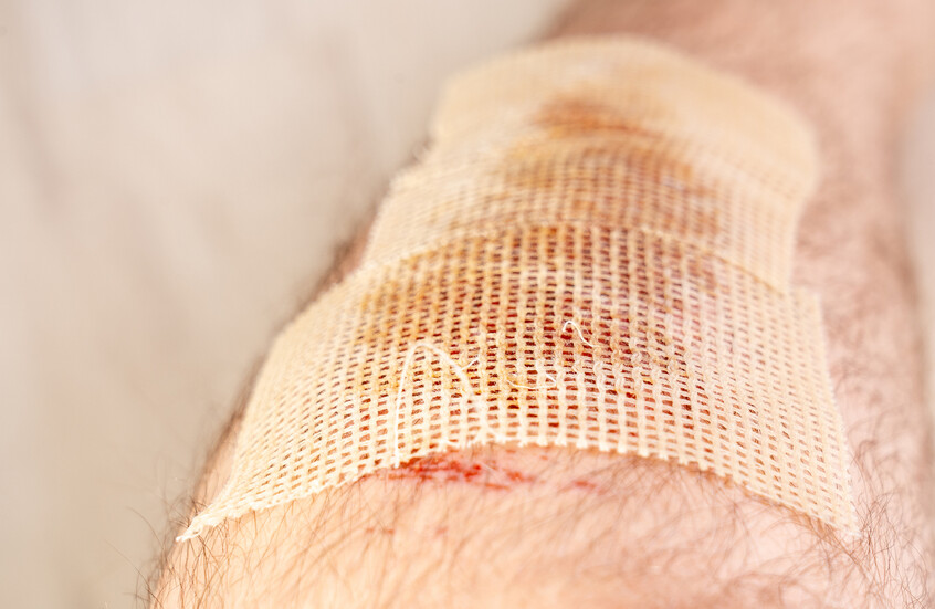 يصل إلى 10 آلاف ضعف!.. نهج علاجي جديد يعزز فعالية المضادات الحيوية لمكافحة الجروح المزمنة