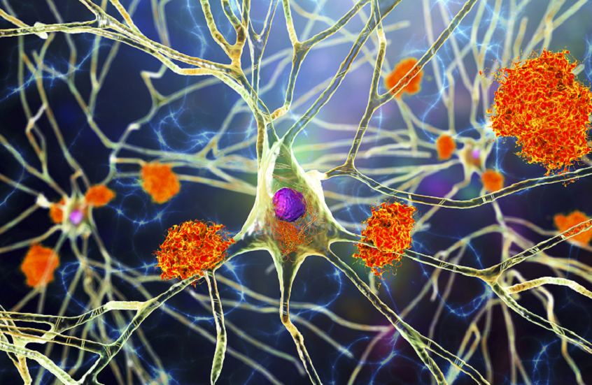 خلطة دوائية ترمم الأعصاب التالفة بسبب التصلب اللويحي