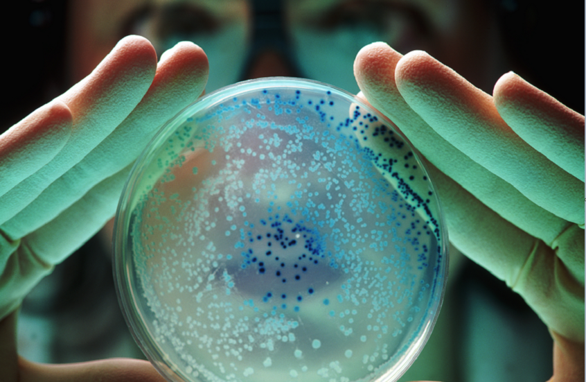 سحب فاكهة ملوثة ببكتيريا خطيرة في الولايات المتحدة