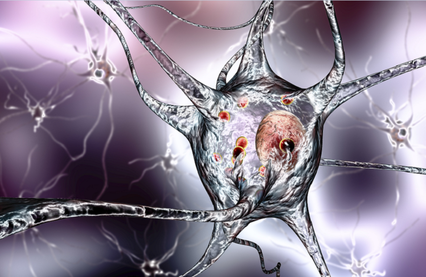 إنجاز علمي جديد يكشف أسرار باركنسون