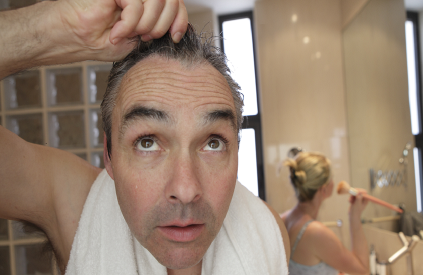 اكتشاف جديد يعزز فعالية علاج الصلع الوراثي