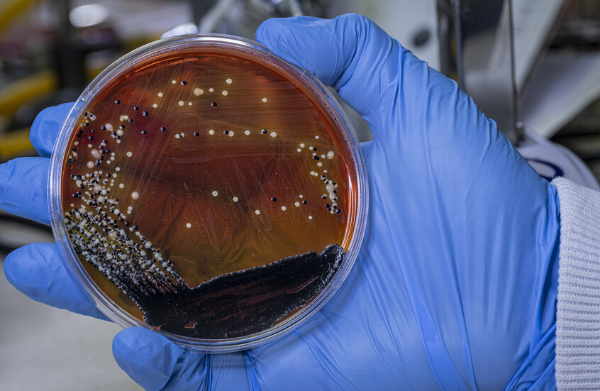 بكتيريا بشرية تتحدى الفضاء الخارجي وتنجو في أقسى الظروف!