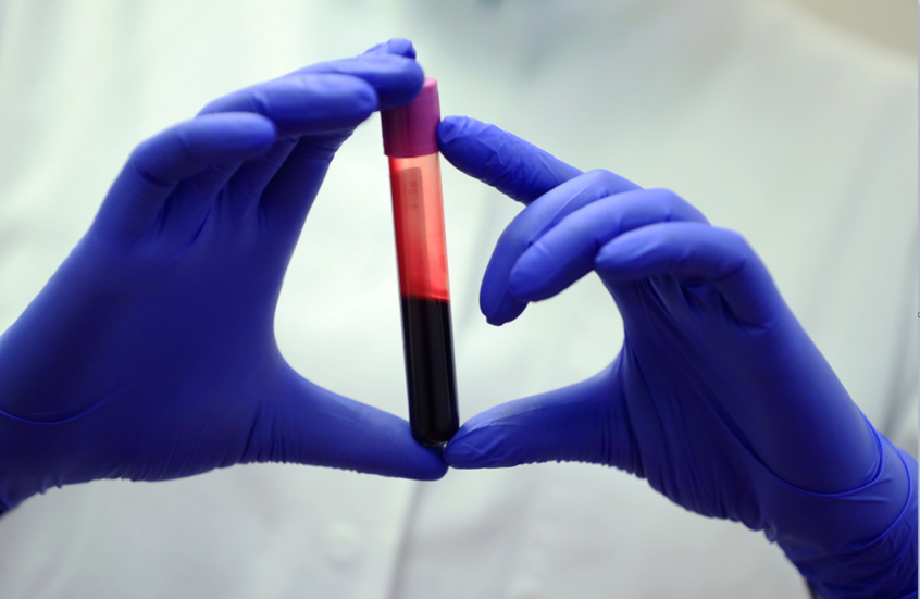 لأول مرة في العالم.. تحليل دم يشخص التعب المزمن بدقة غير مسبوقة