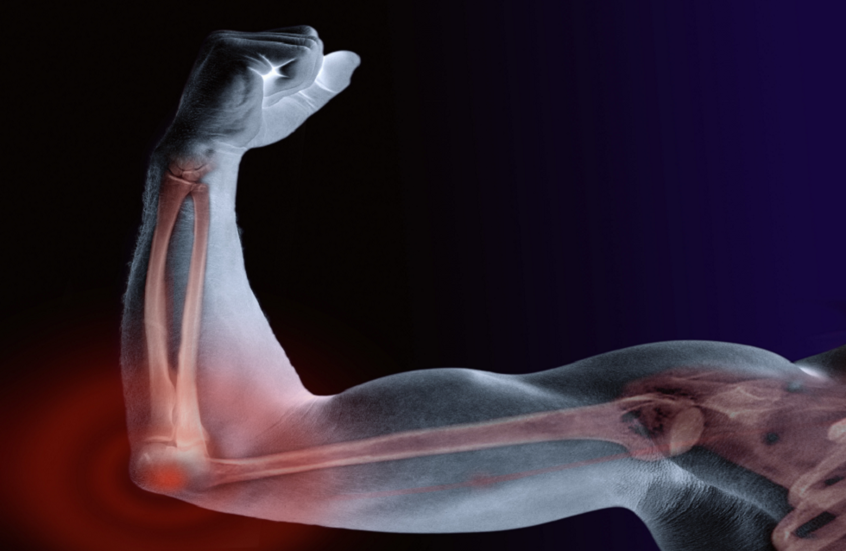 6 أطعمة تقوّي العظام وتحميها مع التقدم في العمر