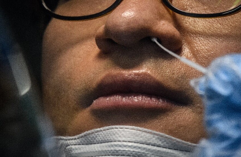 فقدان حاسة الشم من آثار جائحة 