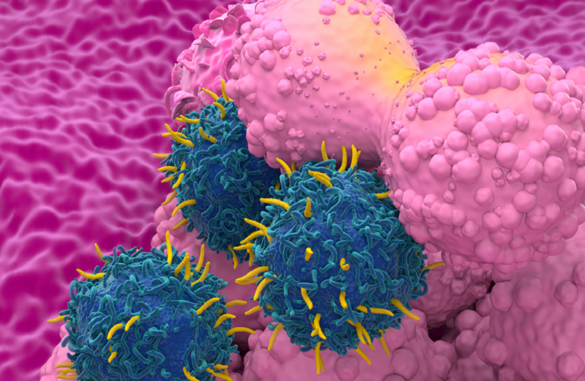 دراسة تحذر: تناول اللحوم المصنعة أسبوعيا يزيد خطر الإصابة بسرطان الثدي