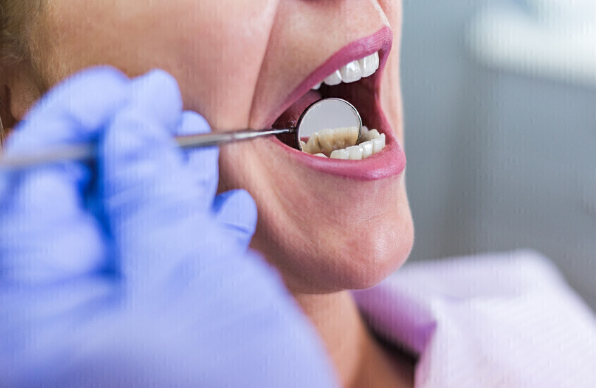 ارتكب 23 جريمة جنسية.. الحكم على صاحب صالون تبييض أسنان في بريطانيا بالسجن 26 عاما