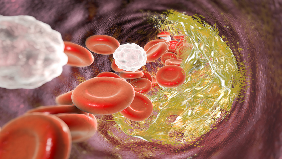 الكوليسترول "الضار" لا يهدد القلب فقط.. بل الذاكرة أيضا!