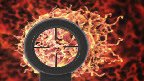 اختراق علمي: اكتشاف جديد يفتح آفاقاً لعلاج فعال لسرطان البروستات